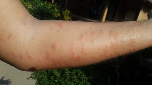 Кто кусается в море в Таиланде